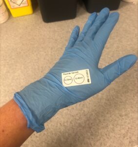 A disposable glove with the Fluoride Varnish sticker stuck to the back of the hand ready for using.